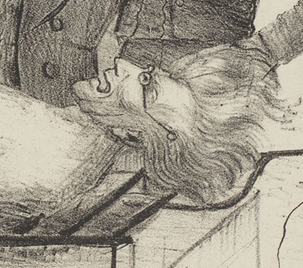 Andrew Jackson's head (detail from "The Political Barbecue")